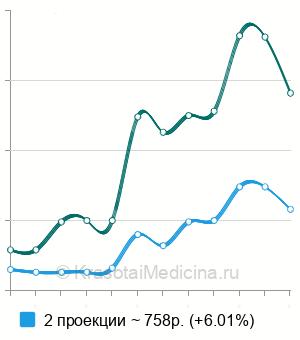 Средняя стоимость рентгенографии предплечья в Нижнем Новгороде