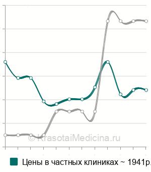 Средняя стоимость фибросканирования печени в Нижнем Новгороде