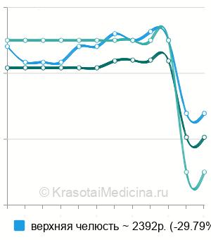 Средняя стоимость КТ челюсти в Нижнем Новгороде