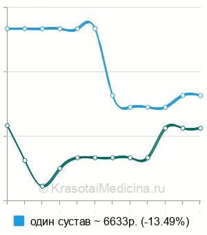 Средняя стоимость МРТ височно-нижнечелюстных суставов в Нижнем Новгороде