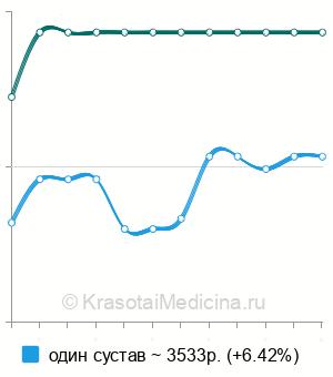 Средняя стоимость КТ тазобедренного сустава в Нижнем Новгороде