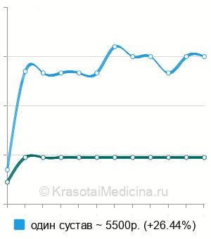 Средняя стоимость МРТ локтевого сустава в Нижнем Новгороде