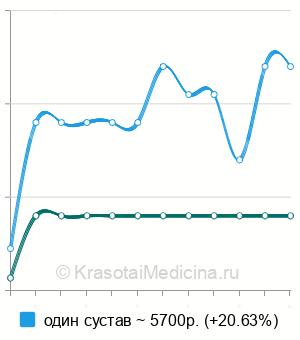 Средняя стоимость МРТ лучезапястного сустава в Нижнем Новгороде