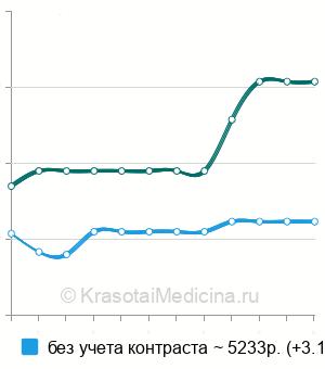 Средняя стоимость МРТ наружных половых органов у мужчин в Нижнем Новгороде