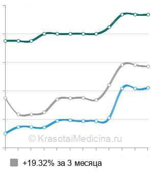 Средняя стоимость МРТ мягких тканей (1 локализация) в Нижнем Новгороде