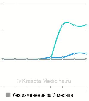 Средняя стоимость анализ на антитела к шистосомам в Нижнем Новгороде