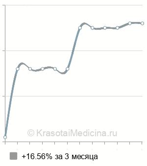 Средняя стоимость антител к трихомонаде в Нижнем Новгороде