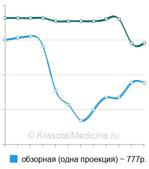 Средняя стоимость рентгенографии легких в Нижнем Новгороде