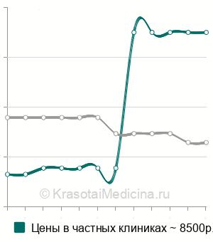 Средняя стоимость спинально-эпидуральной анестезии в Нижнем Новгороде