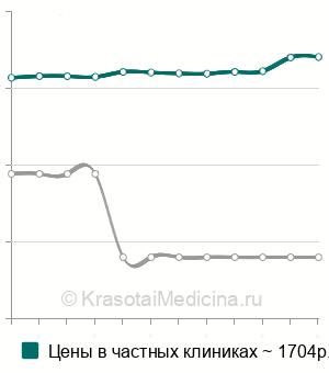 Средняя стоимость антител к рецепторам ТТГ (АТ рТТГ) в Нижнем Новгороде