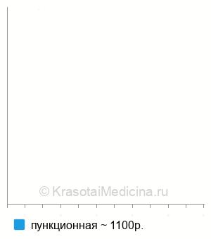 Средняя стоимость биопсии мягких тканей в Нижнем Новгороде