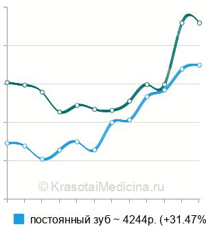 Средняя стоимость лечения пульпита ребенку в Нижнем Новгороде