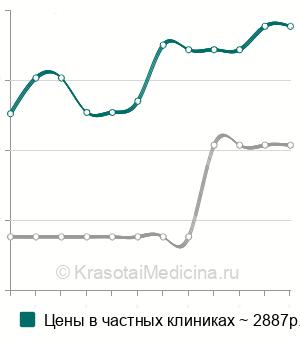 Средняя стоимость краниальная мануальная терапия в Нижнем Новгороде