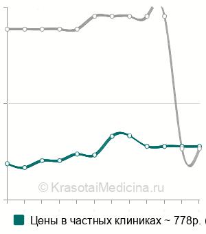 Средняя стоимость удаления инородного тела конъюнктивы в Нижнем Новгороде