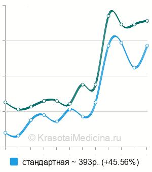 Средняя стоимость биомикроскопии глаза в Нижнем Новгороде