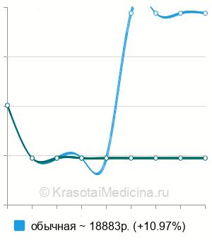 Средняя стоимость дистальная резекция желудка в Нижнем Новгороде