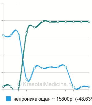 Средняя стоимость глубокая склерэктомия в Нижнем Новгороде