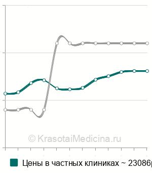 Средняя стоимость коронки из диоксида циркония на имплантат в Нижнем Новгороде