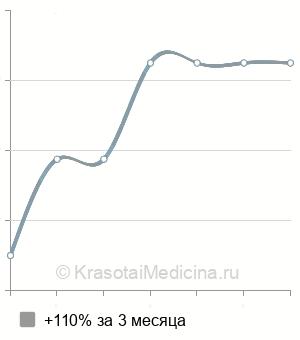 Средняя стоимость пункции гидроцеле в Нижнем Новгороде