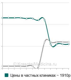 Средняя стоимость вскрытие гематомы носовой перегородки в Нижнем Новгороде