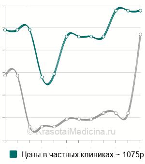 Средняя стоимость парабульбарной инъекции в Нижнем Новгороде