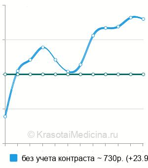 Средняя стоимость рентгенографии пазух носа в Нижнем Новгороде