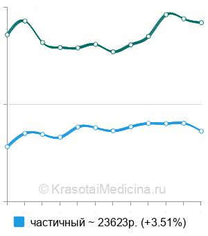 Средняя стоимость нейлонового зубного протеза в Нижнем Новгороде