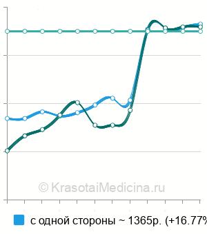 Средняя стоимость пункции верхнечелюстной пазухи в Нижнем Новгороде