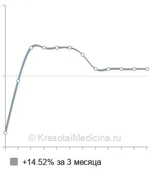 Средняя стоимость КТ надпочечников в Нижнем Новгороде