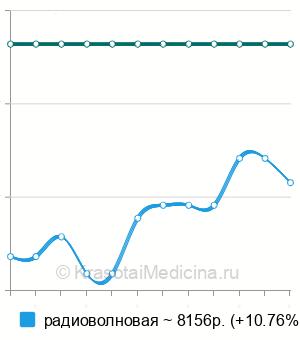 Средняя стоимость лакунотомии в Нижнем Новгороде