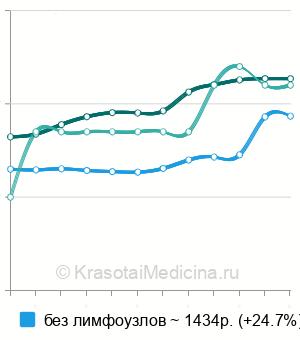 Средняя стоимость УЗИ молочной железы в Нижнем Новгороде