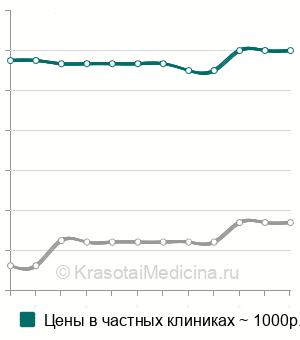 Средняя стоимость УЗИ толстого кишечника в Нижнем Новгороде
