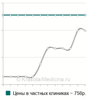 Средняя стоимость УЗИ легких в Нижнем Новгороде