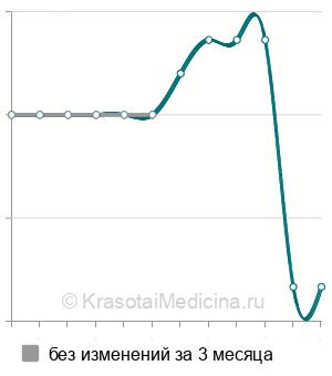 Средняя стоимость уретеролитотомия в Нижнем Новгороде