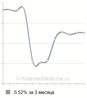 Средняя стоимость подбора контактных линз в Нижнем Новгороде