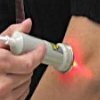 Лазерное лечение грибка кожи