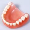 Пластиночный  зубной протез