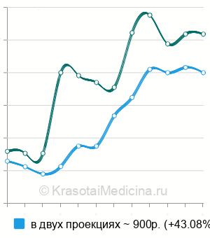 Средняя стоимость рентген грудной клетки в Нижнем Новгороде