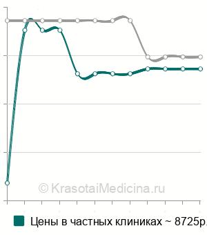 Средняя стоимость ангиография головного мозга в Нижнем Новгороде