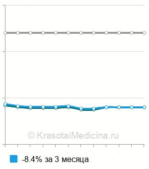 Средняя стоимость КТ черепа в Нижнем Новгороде