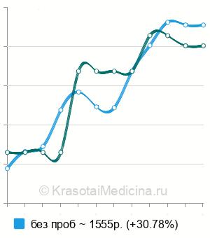 Средняя стоимость электроэнцефалография (ЭЭГ) в Нижнем Новгороде