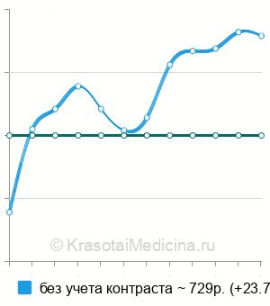 Средняя стоимость рентген околоносовых пазух в Нижнем Новгороде