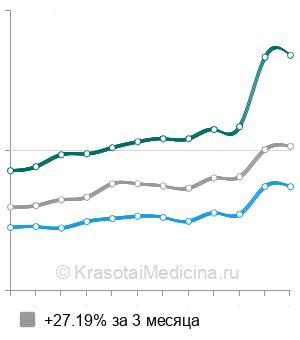 Средняя стоимость УЗИ желчного пузыря в Нижнем Новгороде